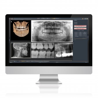 Dental Imaging Software 6.14.7