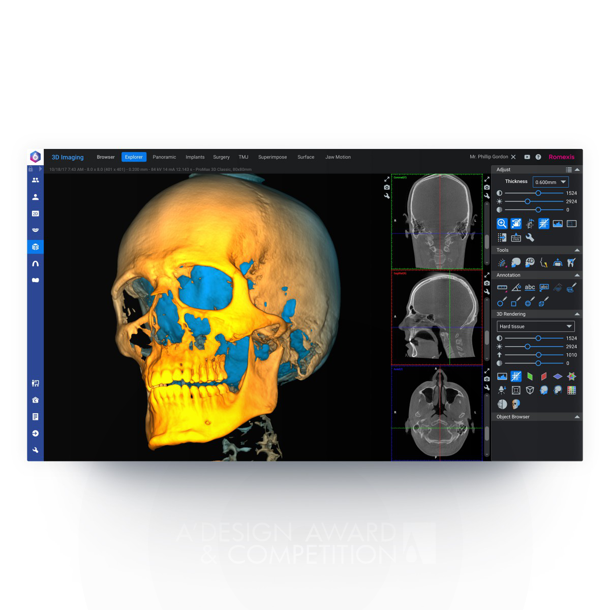Planmeca Dental Imaging Software