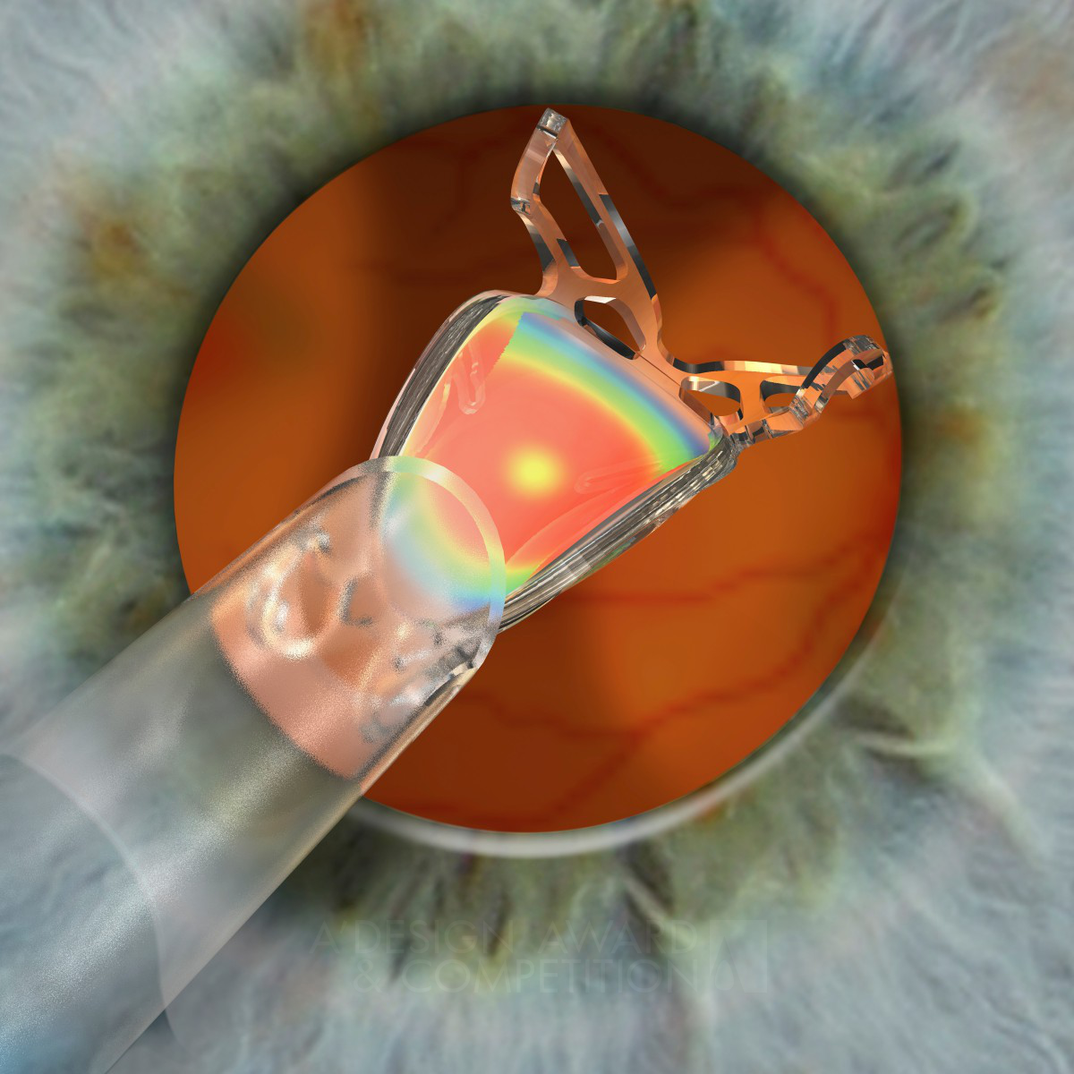 Well Intraocular Lens by Sifi Medtech R&D