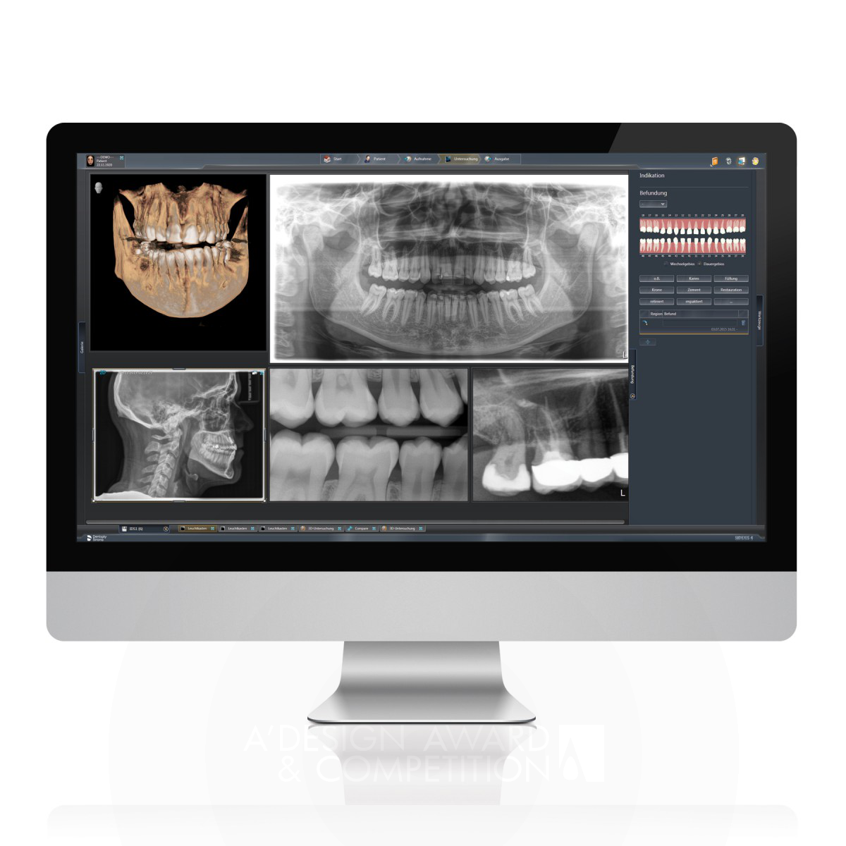 Sidexis 4 Dental X-Ray Software by Peggy Reuter-Heinrich