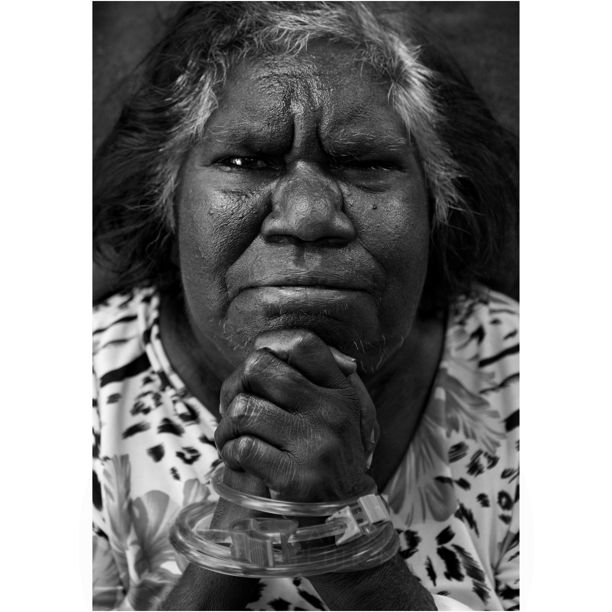 Unfinished Business <b>Awareness - Aboriginal Disability Rights