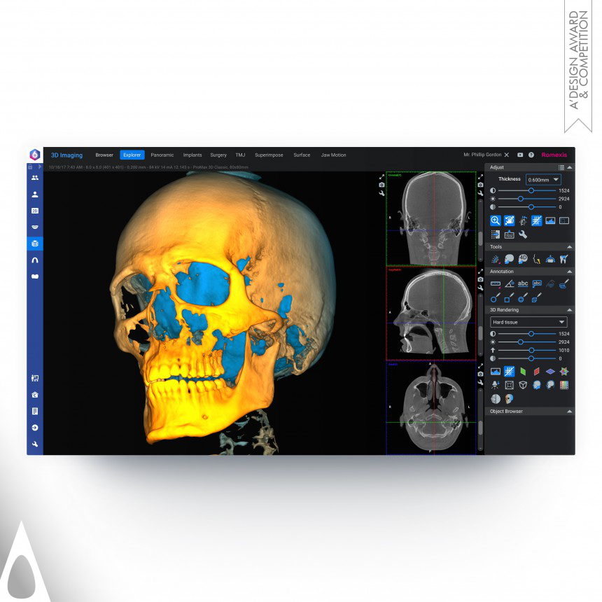 Romexis 6 Dental Imaging Software