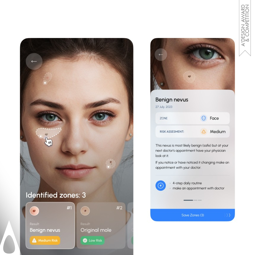 Silver Interface, Interaction and User Experience Design Award Winner 2025 Skinspotter Interface Design 