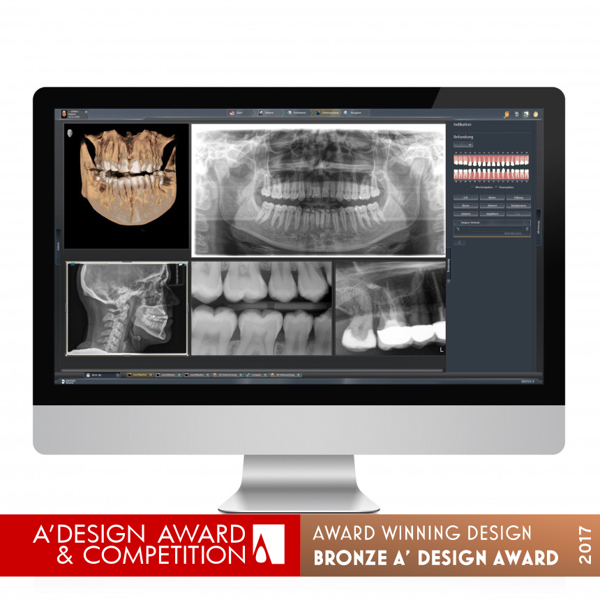 Sidexis 4 Dental X-Ray Software