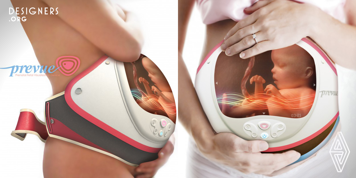 PreVue is a solution to enhancing maternal-fetal bonding as a reassurance window. It is an e-textile based apparatus that uses 4D ultrasound. Latest stretchable display technology is also employed on the abdominal region, allowing other members of the family especially the father to connect with the foetus in its context. PreVue not only gives you the opportunity to interact and comprehend the physical growth of the baby, but also an early understanding of its personality as you see it yawning, rolling, smiling etc., bringing you closer till the day it finally rests into your arms.