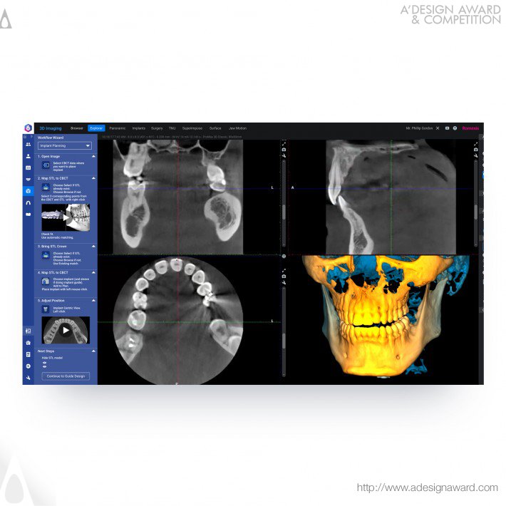 Planmeca - Romexis 6 Dental Imaging Software