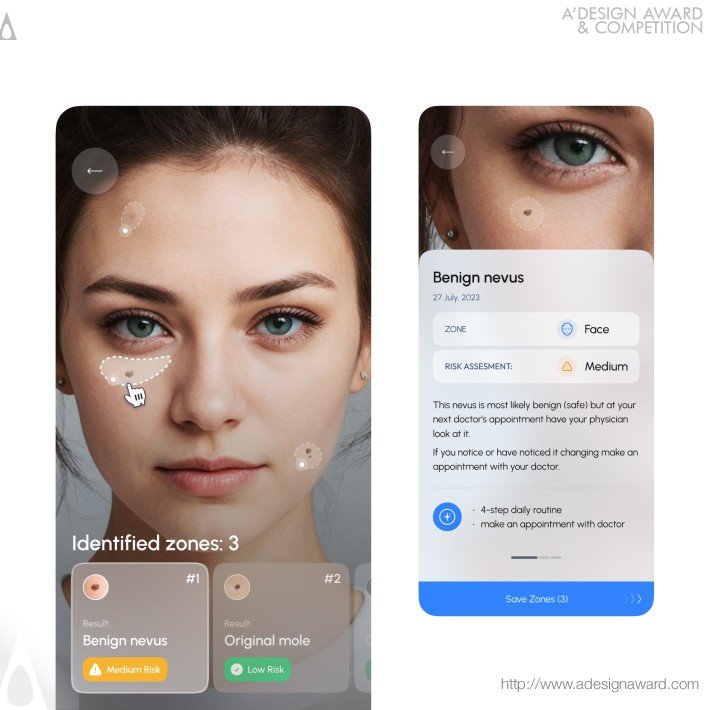 skinspotter-by-linkup-studio-1