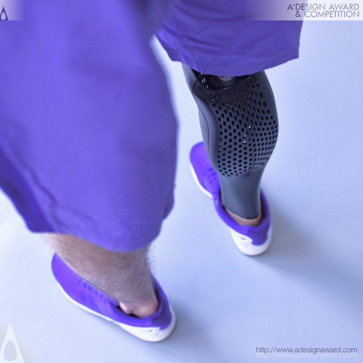 Tomas Vacek, Art4Leg - Art4leg 3d Printed Prosthesis Cover