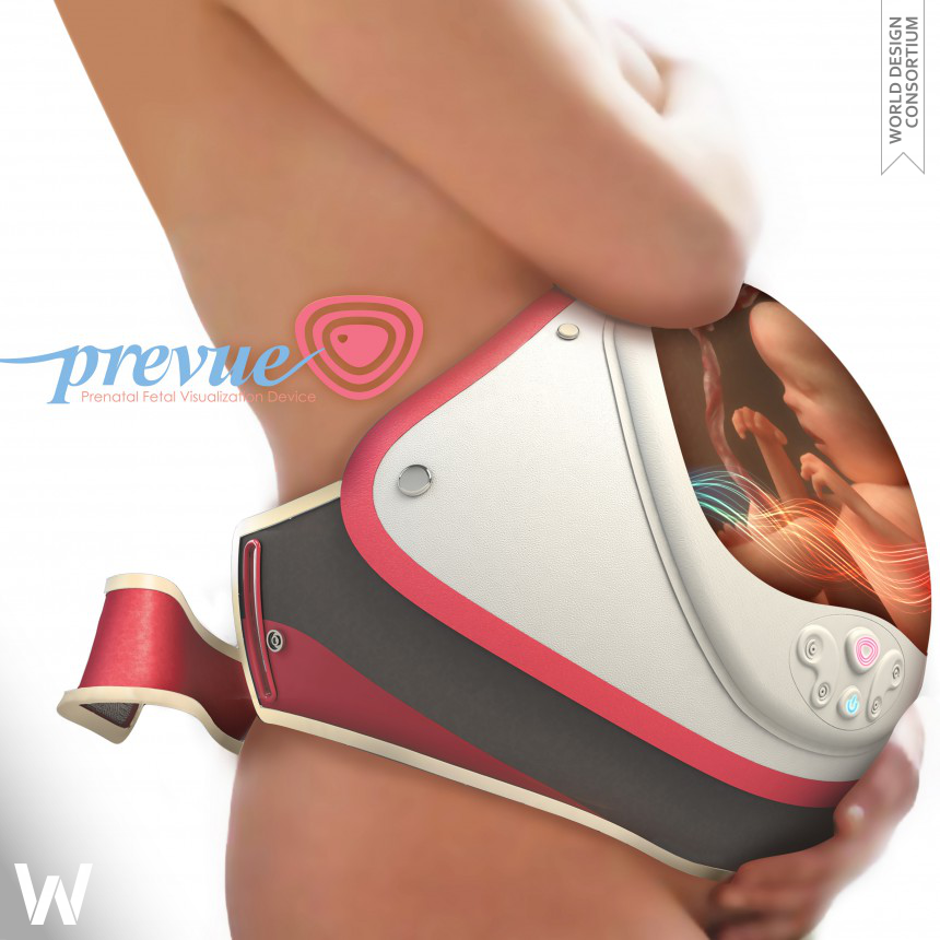 PreVue Wearable pregnancy ultrasound